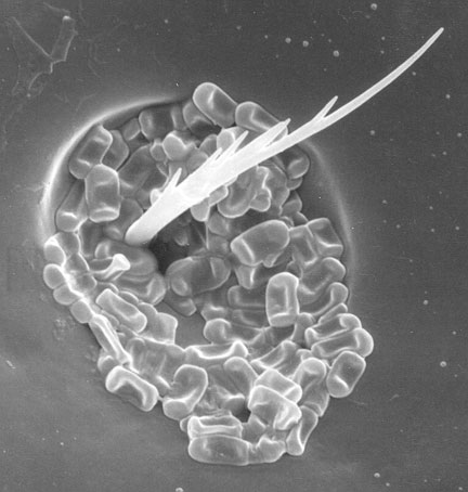 Photographie de spores fongiques dans de petites cavités des élytres du scolyte du pin, un autre scarabée du pin tordu.